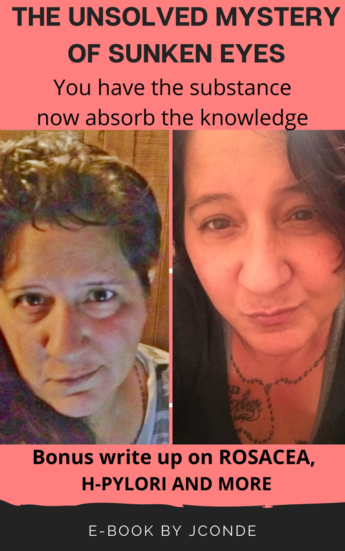 THE UNSOLVED MYSTERY OF SUNKEN EYES