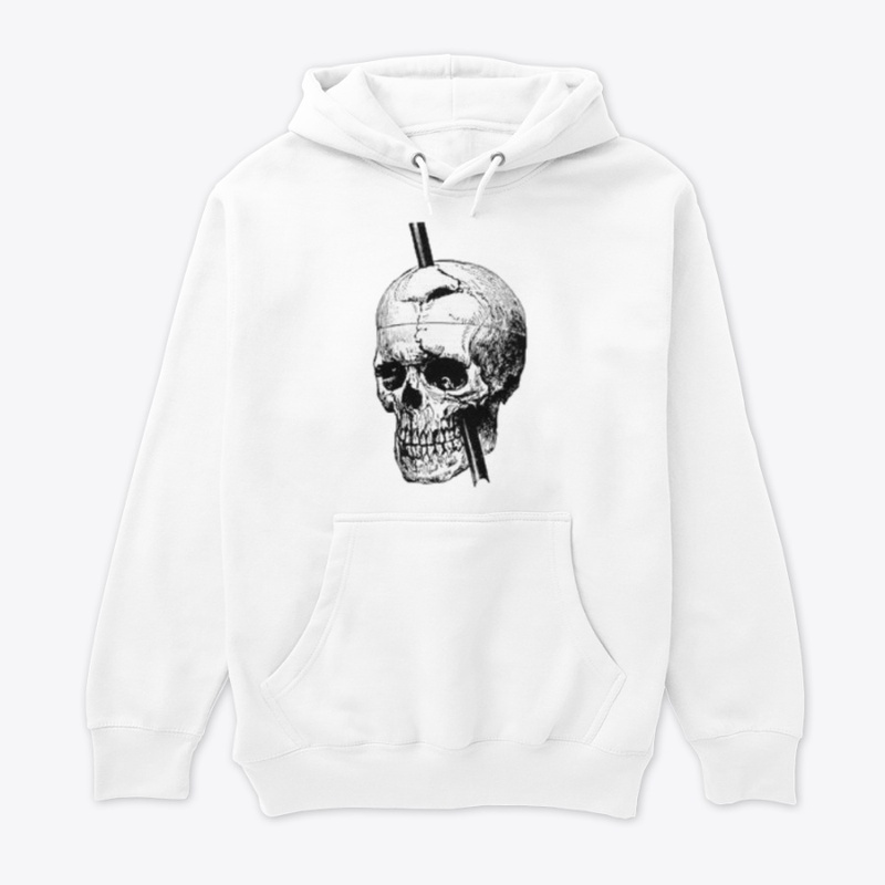 Phineas Gage Skull