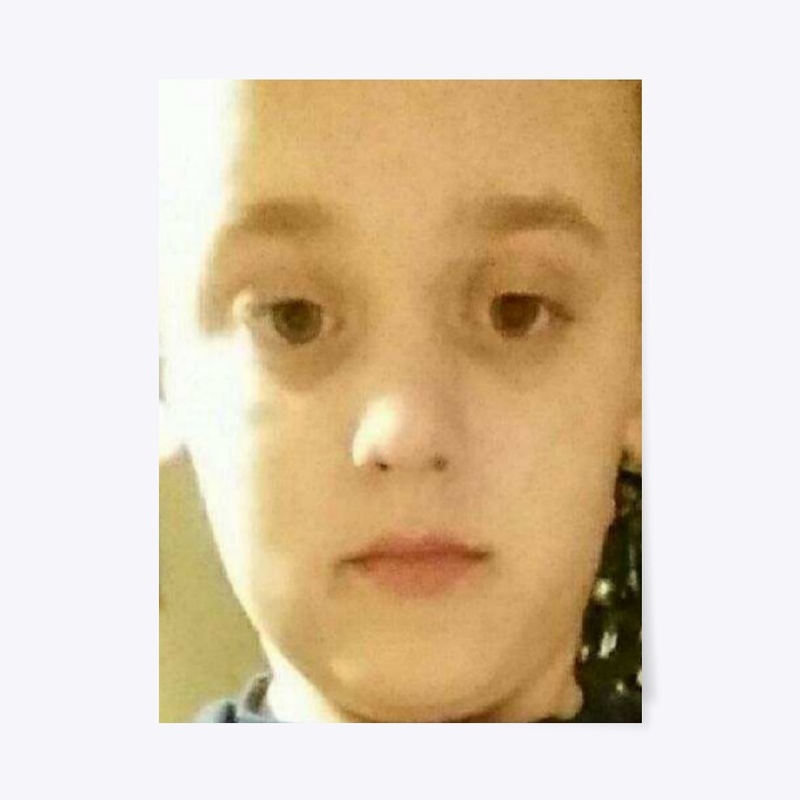 Big Forehead 