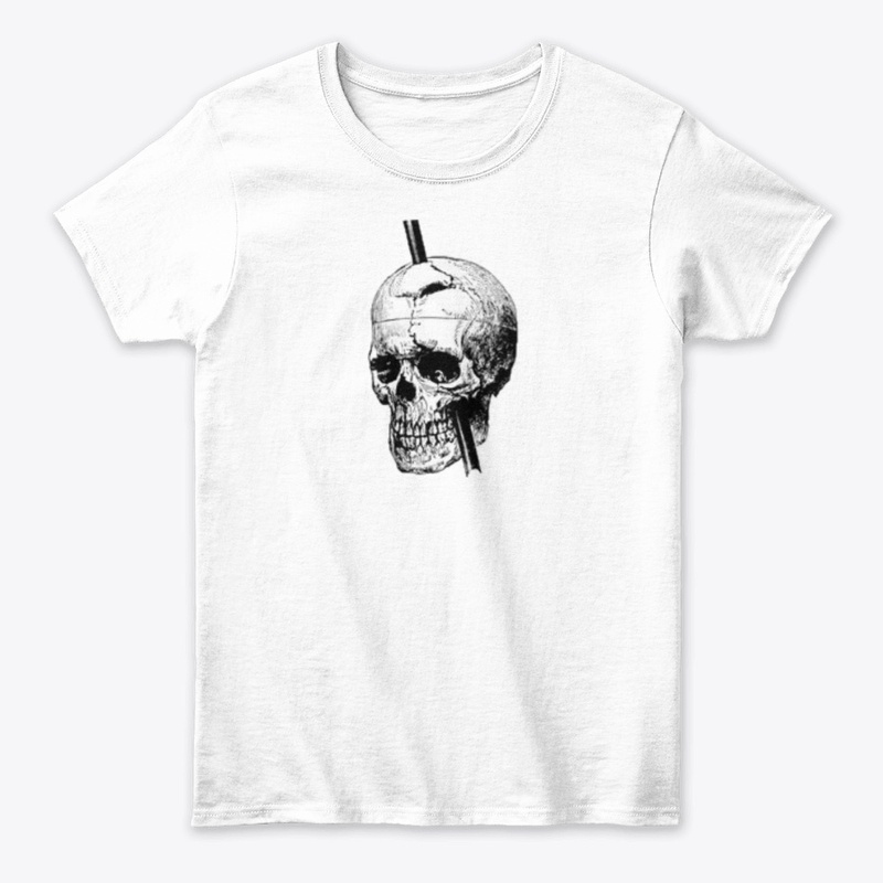 Phineas Gage Skull