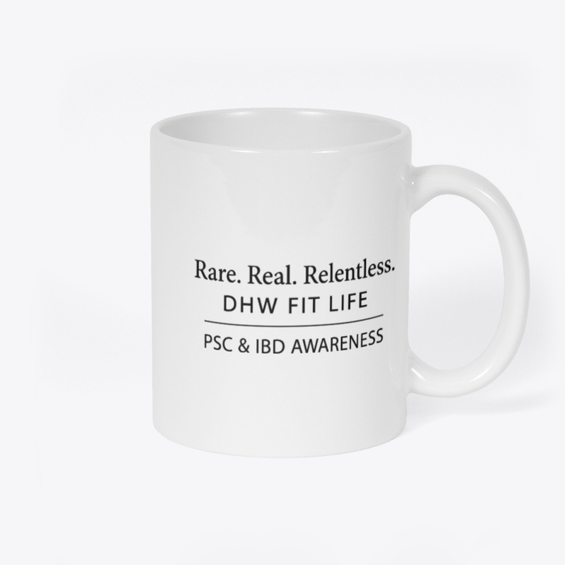Rare but Resilient 