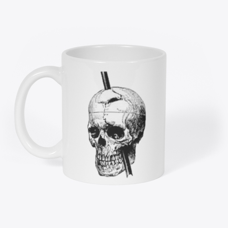 Phineas Gage Skull